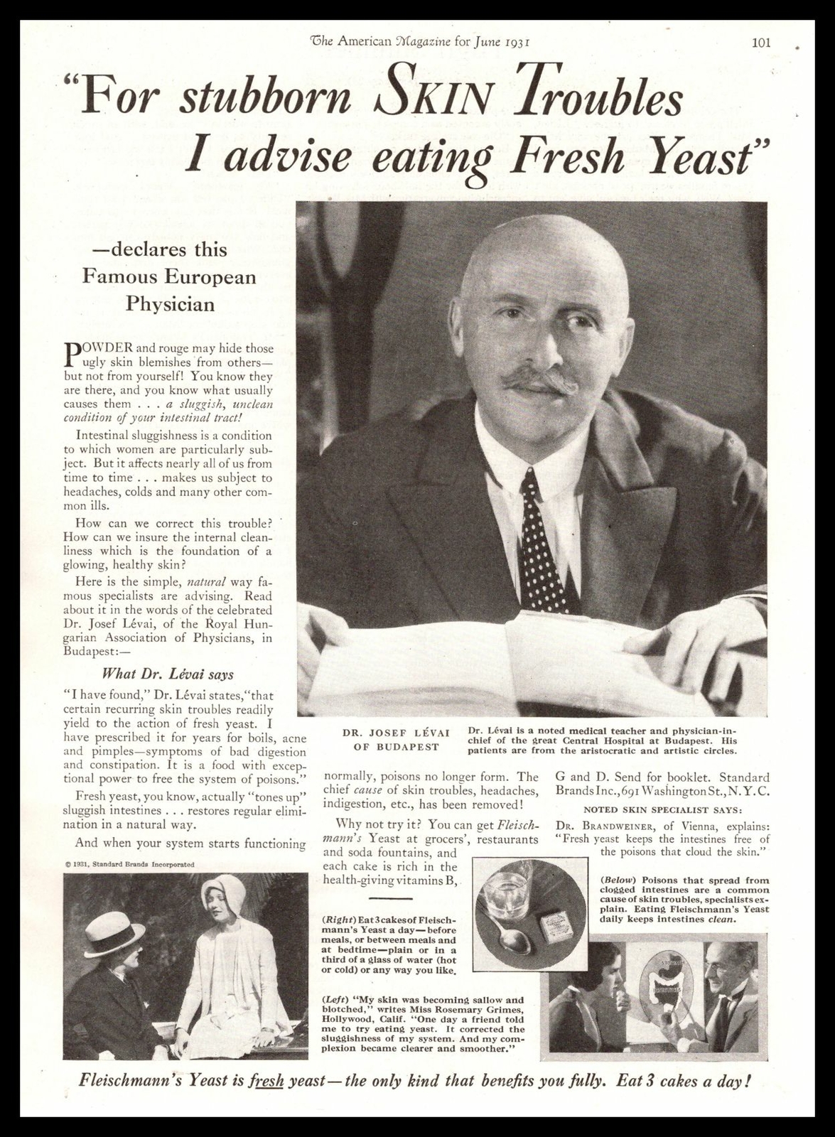 1931 Fleischmann’s Yeast Cakes “For Stubborn Skin Troubles” Vintage Print Ad
