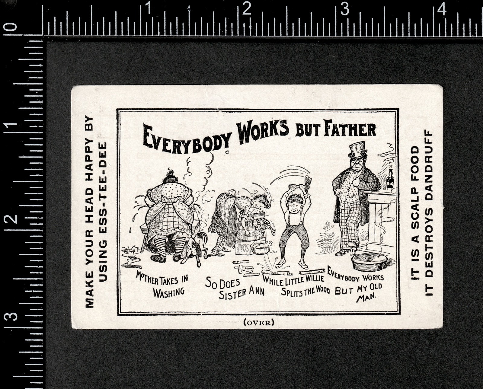 Irish – “Everybody Works BUT Father” Ess-Tee-Dee Hair Scalp Food Trade Card j.US